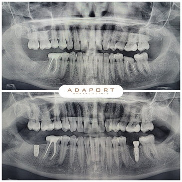 Slider image (2) Adaport Dental Clinic